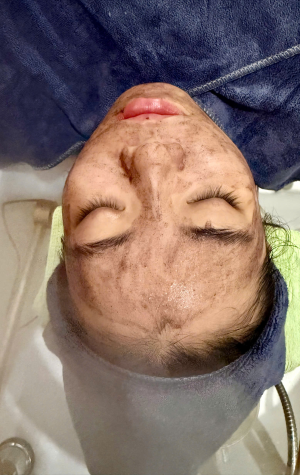 Thải độc da