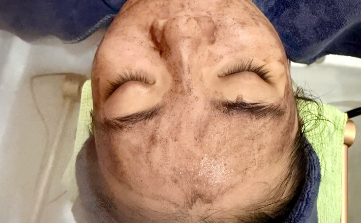 Thải độc da