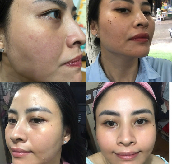 Feedback khách của Nắng's Spa