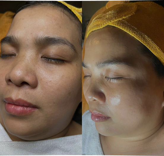 Lâm Ngọc Anh Minh-2